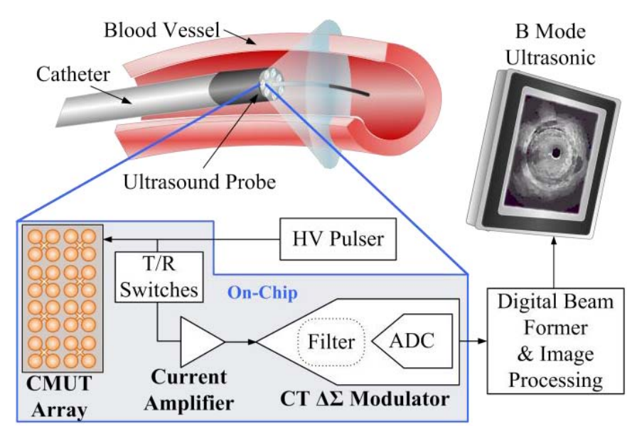 Ultrasound – MicroSensing & Systems